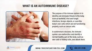 What is Autoimmune Disease