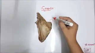 Scapula bone  Demonstration II Most FAQ for Viva