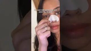 Trying safe nose strips to remove blackheads #blackheads #skincare #safe #nosestrips