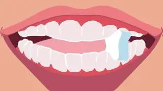Movemints, the Mint that Fits&trade; Your Clear Aligners!