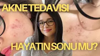Zoratenin Tedavi Sürecim Nasıl İlerledi?