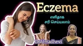 Skin disease ,Eczema complete cure siddha& flower Remedies.