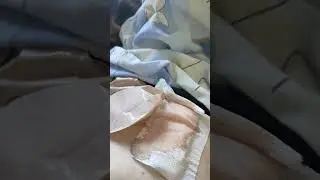 зашили в больнице без обезболивания