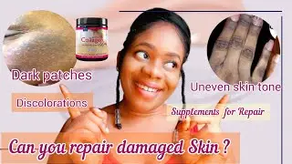 How to Repair Damaged Skin caused by over-use of skin lightening products | discoloration,thin skin