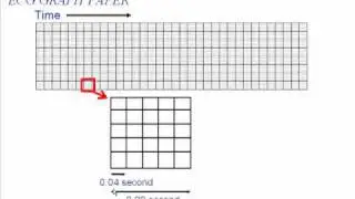 ECG Graph Paper