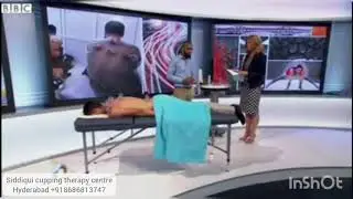 cupping therapy Hijama Demo on BBC National News - 9/08/16
