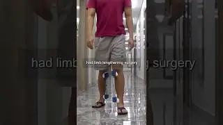 A Patient's Progress in 20 Days: Leg Lengthening Surgery with the LON Method #limblengthening