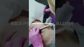 Единственный аппарат, который лечит &laquo;старость&raquo; кожи 🕰