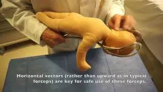 Which Forceps!?