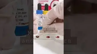 Let's do blood typing #blood #bloodgroup #medtech #Rh #Rhpositive #abobloodgroup