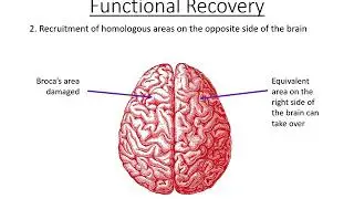 3.  Brain Plasticity