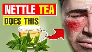 What Happens To Your Body When You Drink a Cup of Nettle Tea Daily?