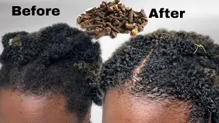 how to moisturize and grow natural hair fast whilst in BRAIDS! Use cloves water and cloves butter