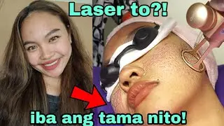 ni LASER ulit ang Face ko! màsakit ba‽