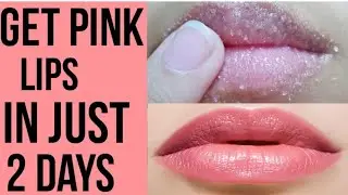 Get Baby Soft Pink Lips in just 1 Day Naturally at Home (Easy & 100% Works),&nbsp;&nbsp;Get Rid Of Dark Lips 