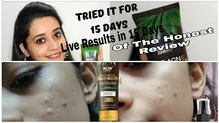 #wowantiacnefacewash  Wow Anti Acne Face Wash Unboxing & Review & Use For 15 Days & Get Results