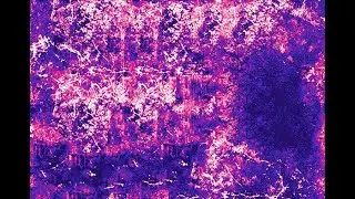 encephalitis - a dnb extratone track