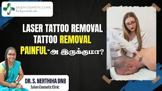 Permanent Laser Tattoo Removal | Tattoo I Skin Tattoos