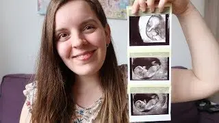 Tehotensk&yacute; update 1.trimester