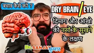 DRY EYE/BRAIN VEINS | Dry Brain Nerves | aankho ki nas ka sukhna | dimag ki naso ka sukh jana