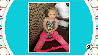 The surgery giving this 3-year-old full mobility after developmental d...