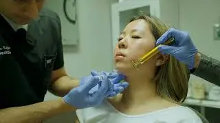 Chin Filler Demonstration | Botox & Filler Injection Training | Cosmetic Injector Certification