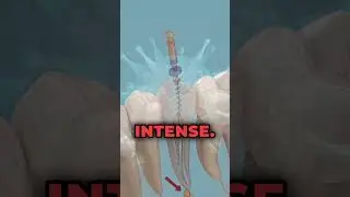 Douleur de dent #dentist #science #astuce #shorts #shortvideo