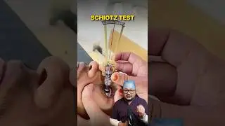 This Old Device Measured Eye Pressure for 100 Years | Doctor Explains