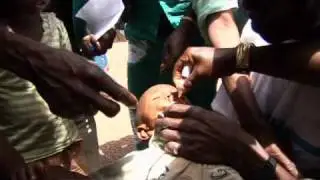 UNICEF: Polio is back in Guinea