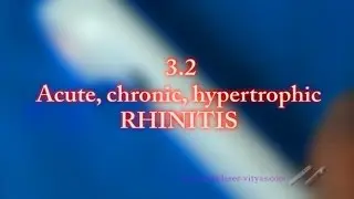 3.2 Rhinitis. Acute rhinitis. Chronic rhinitis. Hypertrophic rhinitis - Cold Laser Vityas