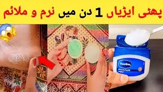 How to Remove Cracked Heels In Overnight#White Smooth or Soft Feet Permanently#diyremedyforCrackheel