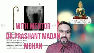 Orthopaedics Theory Memory Course Dr.Prashant Madan Mohan Mentorexam.com  DNB MS final FNB NEETSS