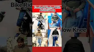 Below Knee Prosthetic Leg #artificialleg #bornlife #prostheticlimb #foryou #ytshorts #shorts #fyp