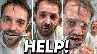 This RUINED his Face! *Help!*