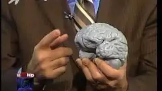 How a Gunshot Wound Affects the Brain (with a model of the brain): Dr. Kornel on Fox 5 NY