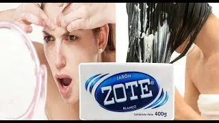 BENEFICIOS DEL JAB&Oacute;N ZOTE PARA LA SALUD 🧼🧼🧼