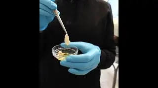 Modern Dentistry is Holistic Dentistry- Stem Cell Therapy