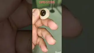 Artificial Eye Bangladesh #artificial_eye_bangladesh