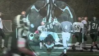Henry Ford Sports Medicine Minute - Concussion Safety - Part 2