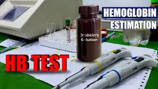 Haemoglobin Test Procedure | Hgb Blood Test Method | Blood Hemoglobin