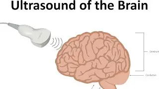 Cord Around Baby&rsquo;s Neck Did Brain Injury (HIE) Happen During Pregnancy Or Labor & Delivery?