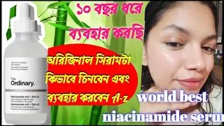 The ordinary niacinamide serum💥এত ভাল রেজাল্ট আর কোন সিরাম ব্যবহার করে পাইনি আমার সব থেকে বেস্ট 😱.