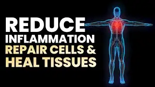Instant Body Pain Relief Meditation | Reduce Inflammation And Pain | Repair Cells & Heal Tissues