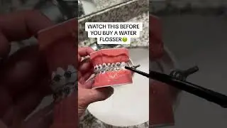 Top Dentist Reveals Shocking Water Flosser Secrets