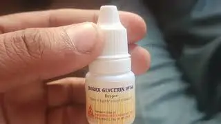 Borax Glycerine l Mouth Ulcer l Pharma l Medicine l Borax Glycerine Use in Hindi l