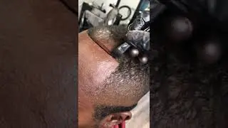 Applying Hair Enhancements On A Front Line UP
