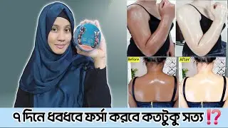 Aceso Body Whitening Cream | Aceso body whitening cream review|Body Whitening Cream|Moriom Akter Mim