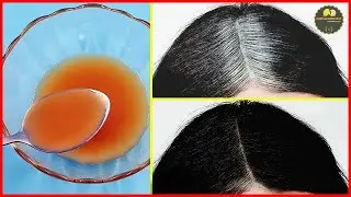 Graues Haar wird ohne Farbstoffe oder Chemikalien dank dieser hausgemachten Mischung verschwinden