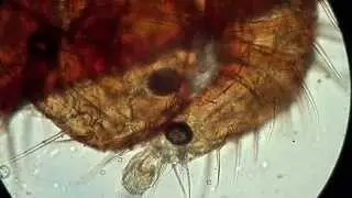 Клещ Варроа Под Микроскопом: Опыт 7:  Varroa destructor, Ужасный и Опасный x400