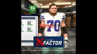 CAN A LINEMAN HAVE SUPERSTAR X FACTOR IN MADDEN 20???